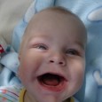 Mateuszek’s Big Smile Mateusz, after surgery, gives a big smile to all of you who helped him.